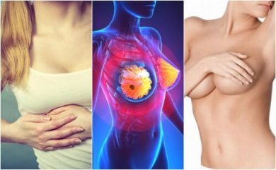 Câncer de mama: 9 sinais que toda mulher deve conhecer