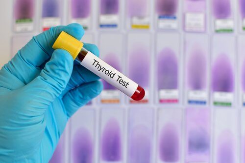 Teste de sangue no hipotireoidismo