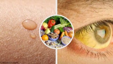 10 deficiências de vitaminas comuns e suas soluções