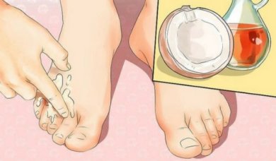 4 formas de se desfazer dos nódulos nos pés