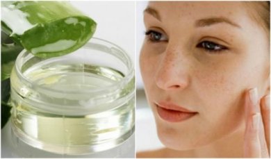 Como fazer um gel caseiro para diminuir as estrias, cicatrizes e manchas