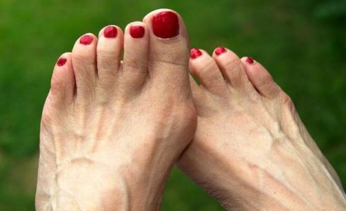 Nódulo no dedão do pé
