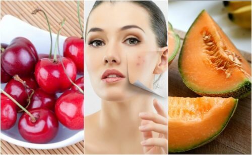 Quer uma pele livre de impurezas? Inclua estes 6 alimentos em sua dieta Quer uma pele livre de impurezas? Inclua estes 6 alimentos em sua dieta