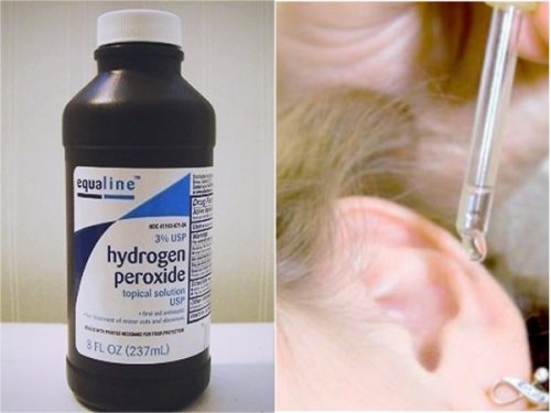 Água oxigenada para remover a água dos ouvidos