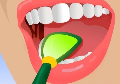 5 truques ideais para combater o mau hálito