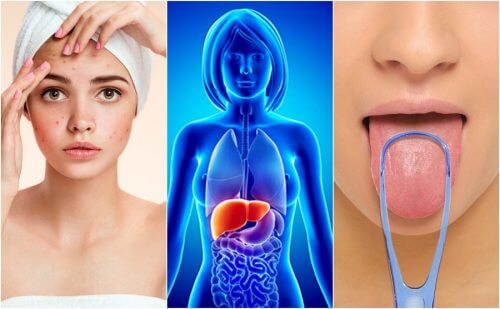 7 sinais de que o fígado está intoxicado 7 sinais de que o fígado está intoxicado