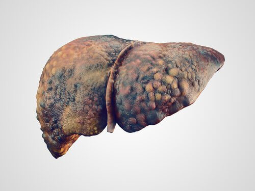 Fígado com cirrose