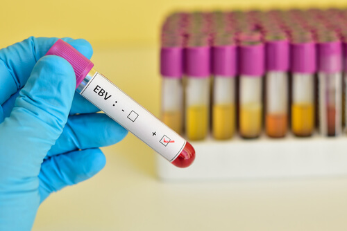 Mão com luva segurando exame de sangue