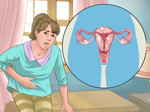 Remédios naturais para distúrbios menstruais