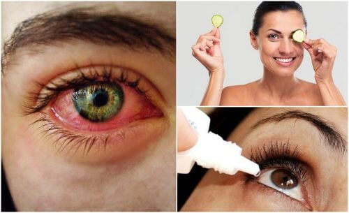 Síndrome do olho seco: o que é e como combatê-la de forma natural