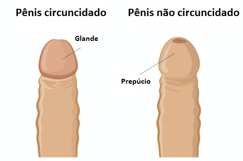 Fimose no pênis