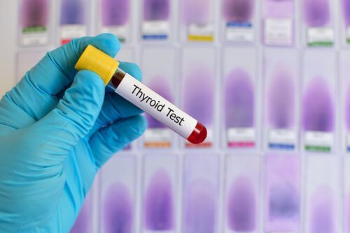Teste de sangue para detectar hipotireoidismo