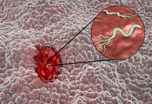 Imagem microscopica do omeprazol