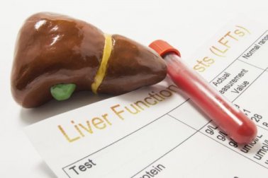 5 causas da fosfatase alcalina elevada