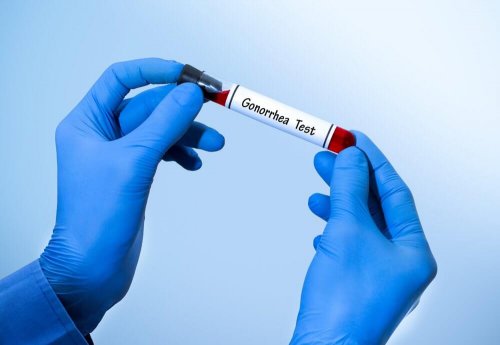 Detectar gonorreia pelo sangue