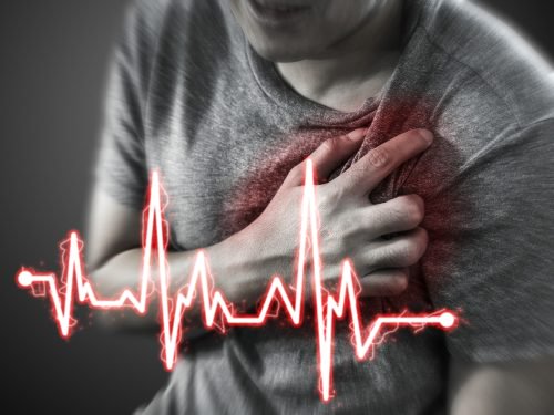 A epigastralgia pode simular um infarte