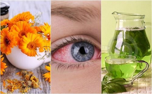 Os 5 melhores remédios para aliviar a conjuntivite naturalmente
