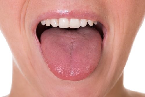 Os 5 primeiros sintomas de câncer de língua Os 5 primeiros sintomas de câncer de língua