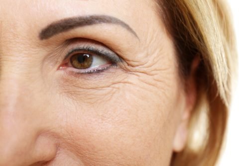 Qual é o significado dos pés de galinha e como preveni-los?