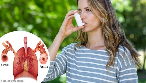 Asma Asma