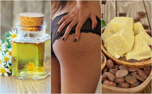 Quer suavizar as estrias do seu corpo? Confira estes 5 remédios caseiros Quer suavizar as estrias do seu corpo? Confira estes 5 remédios caseiros
