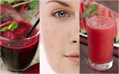 Combata a acne adicionando 5 batidas desintoxicantes em sua dieta Combata a acne adicionando 5 batidas desintoxicantes em sua dieta