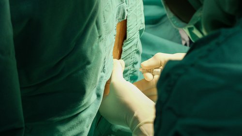 Extração do líquido cefalorraquidiano