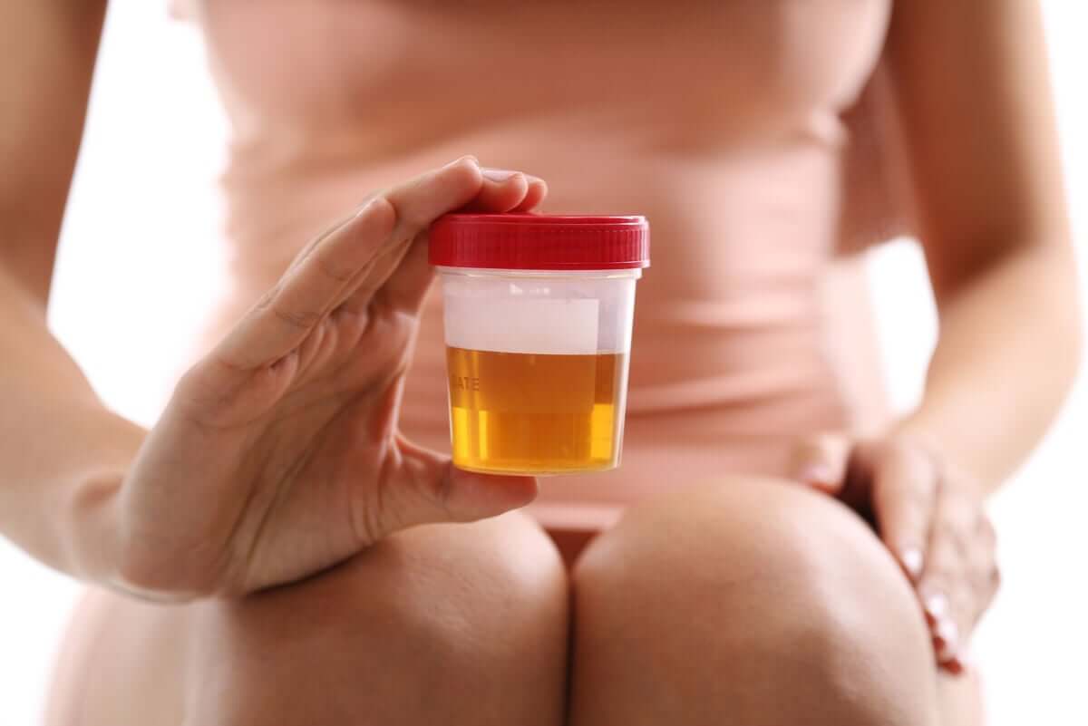 O mau funcionamento dos rins, seja por cálculos ou insuficiência, causa um forte odor na urina