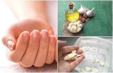 5 tratamentos caseiros para acelerar o crescimento das unhas