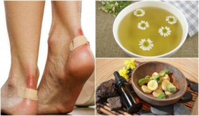 Aliviar as rachaduras nos pés com 5 soluções naturais