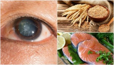 Reduza o risco de cataratas consumindo estes 7 alimentos