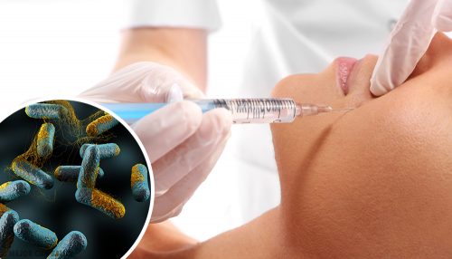 A toxina botulínica, um veneno letal