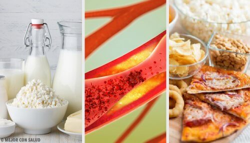 Alimentos que obstruem as artérias Alimentos que obstruem as artérias