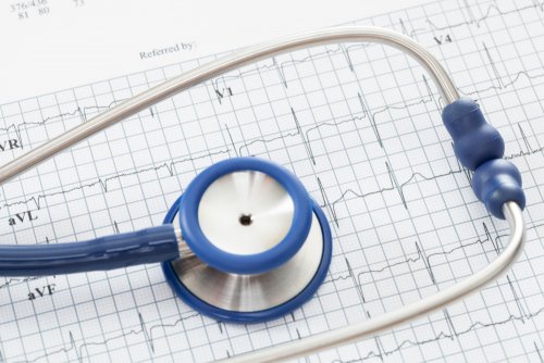 Eletrocardiograma de uma arritmia