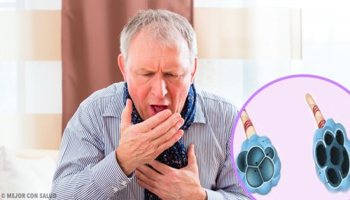 Doença pulmonar obstrutiva crônica (EPOC)