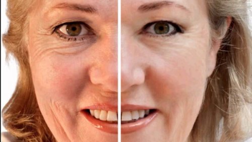 Consumir ameixas secas ajuda a manter uma pele livre de rugas