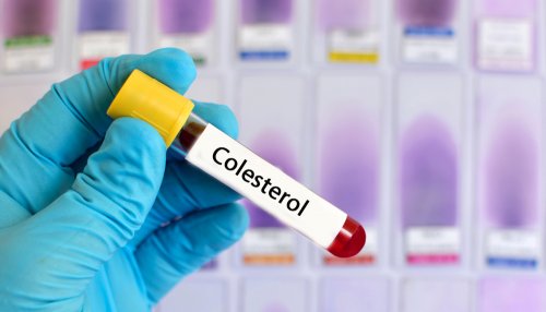 O mel ajuda a normalizar seu nível de colesterol