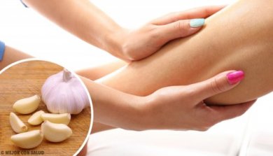 Remédios naturais para reduzir edemas