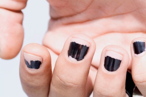 Roer as unhas pode ser uma das razões das unhas frágeis