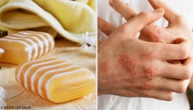 Como fazer um sabonete caseiro de glicerina, própolis e argila para a dermatite