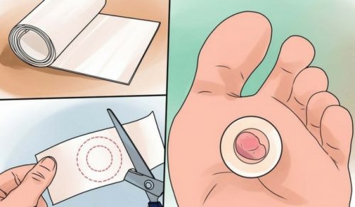 Gaze para acabar com as bolhas
