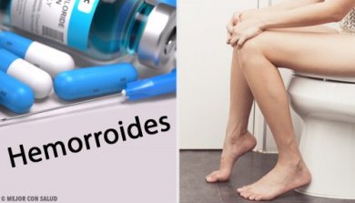 Tratamento de hemorroidas