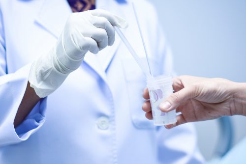 Médico fazendo biópsia das lesões contra o papiloma humano