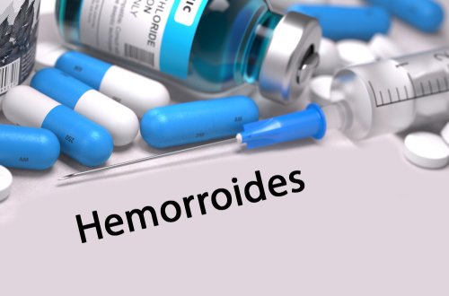 Medicamentos para tratar as hemorroidas
