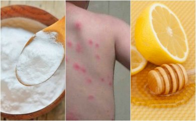 Alivie as picadas de pulgas com 5 remédios naturais