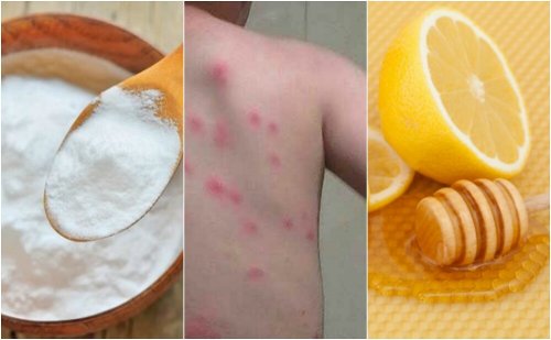 Alivie as picadas de pulgas com 5 remédios naturais