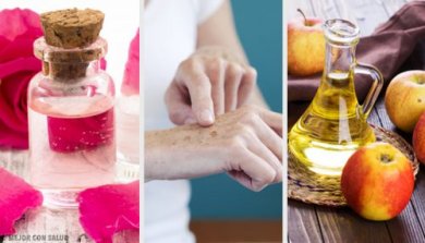 8 remédios naturais para clarear manchas nas mãos