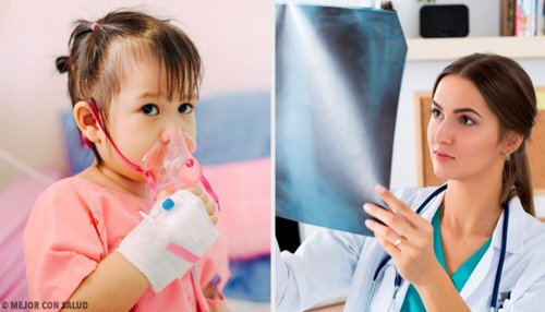 Conheça o tratamento da pneumonia
