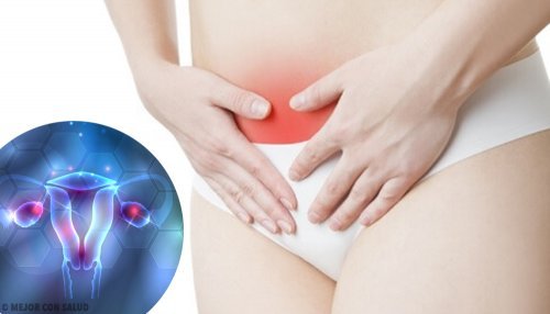 Endometriose