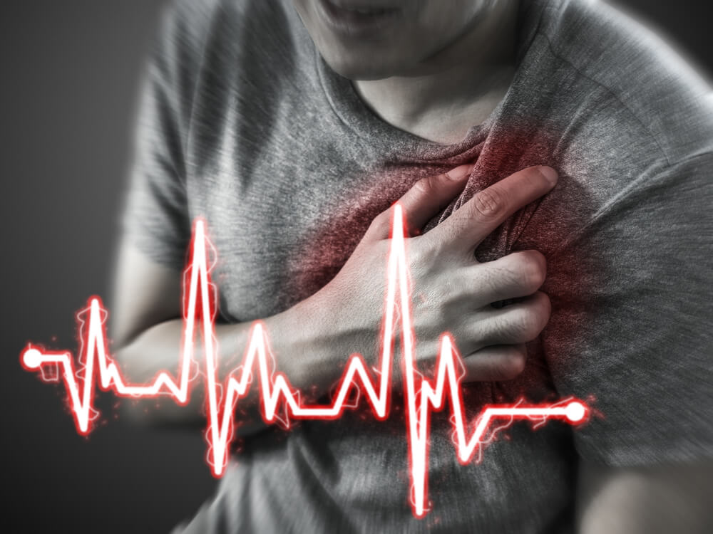 Infarto agudo do miocárdio